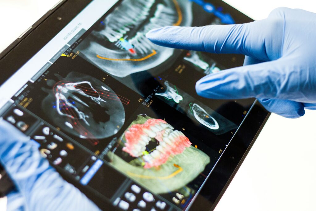 radiographie dentaire